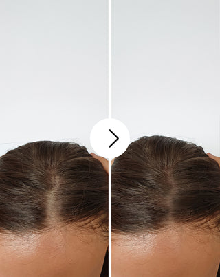 Kapslar för håravfall med en förtjockande och stärkande effekt Follixin 60 kapslar_4 - 4