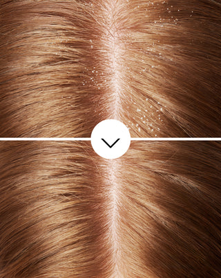 Nutridome anti-mjäll hårschampo med piroctone olamin med en fuktgivande effekt - 5