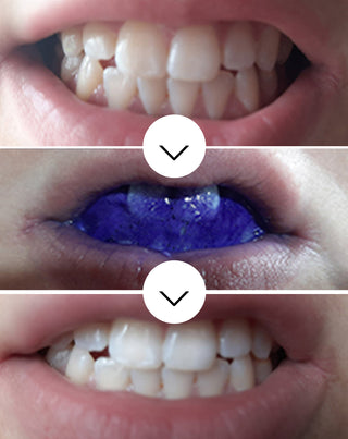 White Bite Smilebite tandfärgskorrigerande serum 30 ml - 2