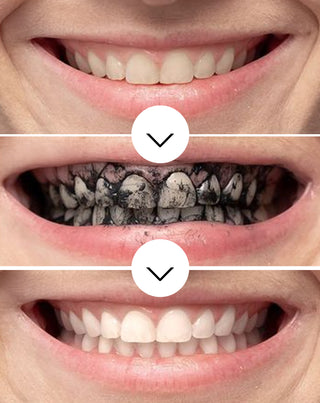 Smilebite kokoskol tandblekningspulver