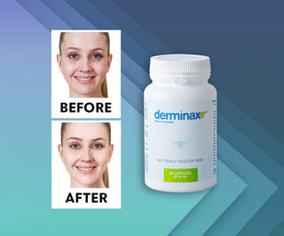 Akne, finnar och ojämnheter tabletter med zink, vitamin C, E och B2 Derminax - 2