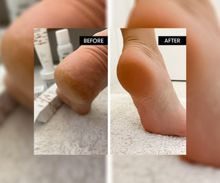 Refeet kylande fotgel med eukalyptusolja - 6