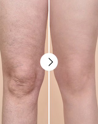 Piller för celluliter och förbättrar hudtillståndet med naturliga Cellinea-extrakt, 60 kapslar - 5
