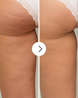 Piller för celluliter och förbättrar hudtillståndet med naturliga Cellinea-extrakt, 60 kapslar - 3