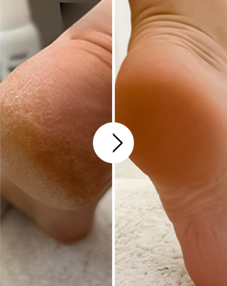 Nutridome mjukgörande fotkräm med urea och sheasmör - 4